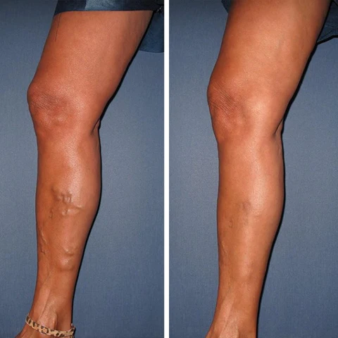 Oveallgo™ VeinCare MagAcupoint Reflexology Insole - Image 2