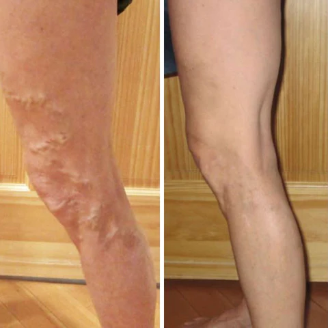 Oveallgo™ VeinCare MagAcupoint Reflexology Insole - Image 3