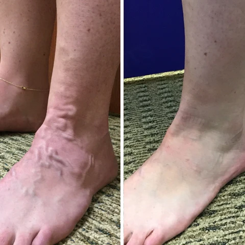 Oveallgo™ VeinCare MagAcupoint Reflexology Insole - Image 4