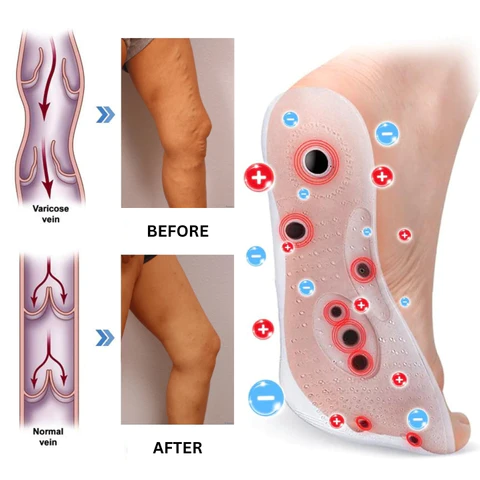 Oveallgo™ VeinCare MagAcupoint Reflexology Insole - Image 6