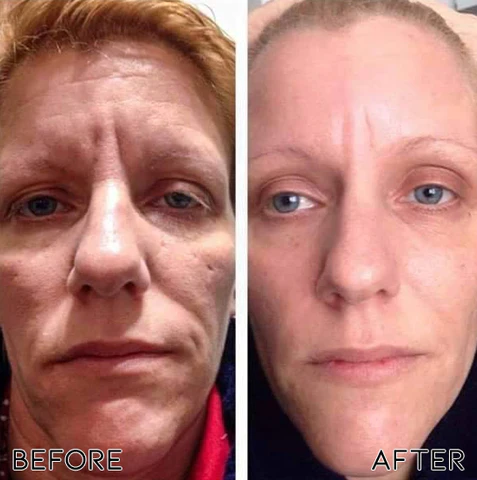 Oveallgo™ PRO Rejuvenating Bioactive Collagen Nasal Inhaler - Image 5