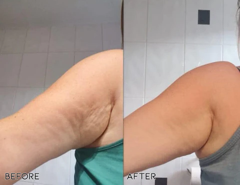 Oveallgo™ Fast Fat Burning & Firming Cream - Image 2