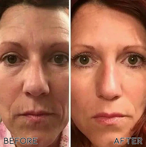 Oveallgo™ PRO Rejuvenating Bioactive Collagen Nasal Inhaler - Image 4