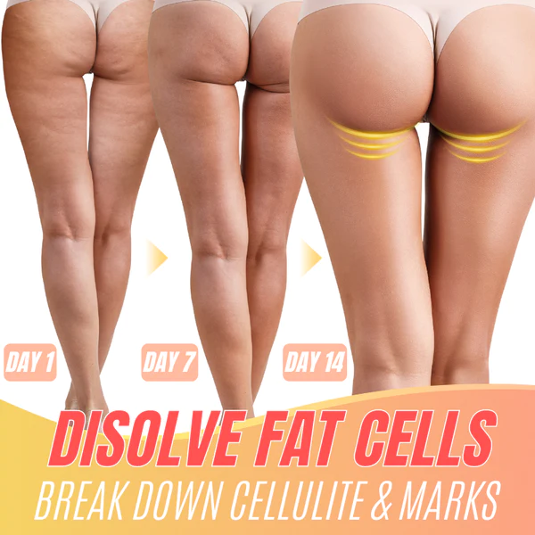 Cellu-Lite™ Thigh Firming Wrap - Image 2