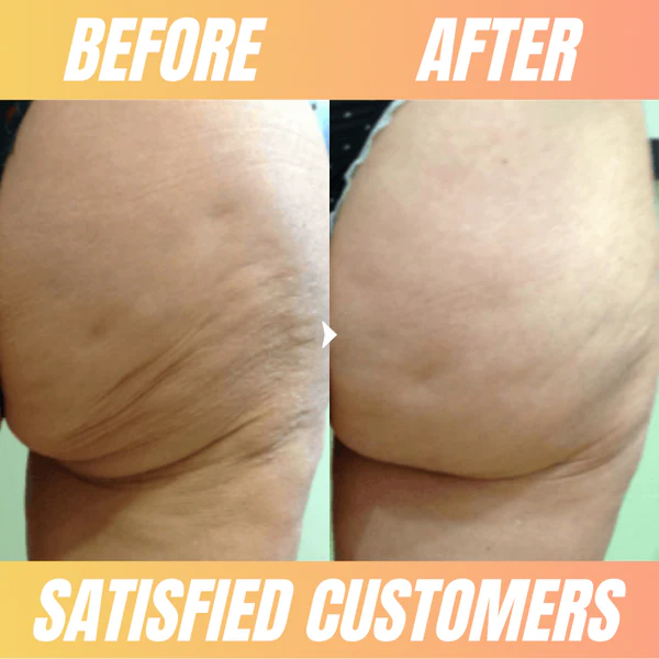 Cellu-Lite™ Thigh Firming Wrap - Image 5