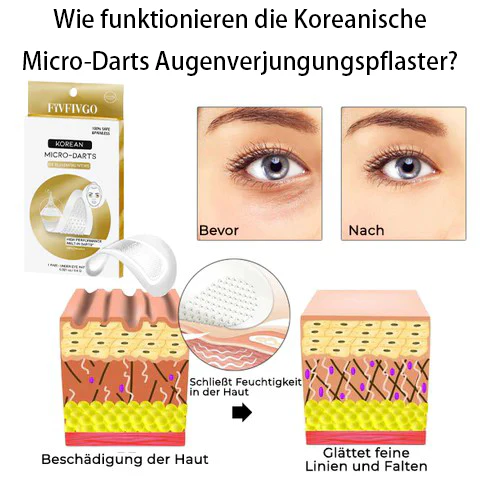 Korean Micro-Darts Eye Rejuvenation Patch - Image 4