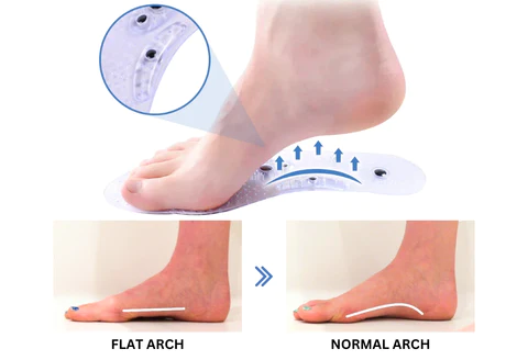 Oveallgo™ VeinCare MagAcupoint Reflexology Insole - Image 8