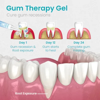 GFOUK™ Gum Instant Treatment Gel
