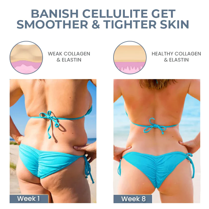 Oveallgo™ Intensive EMS Hip Sculpting Trainer - Image 7