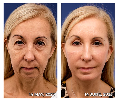 flysmus™ HERASKIN Australian Natural Pamper Cleansing Balm - Image 2