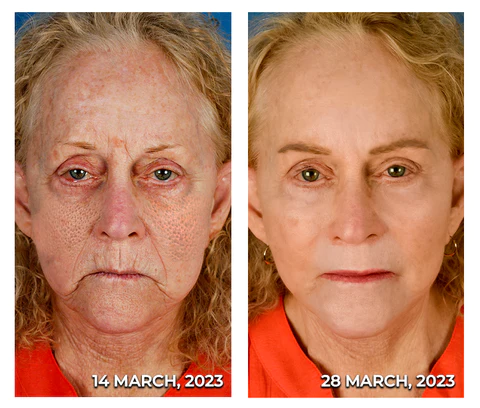 flysmus™ HERASKIN Australian Natural Pamper Cleansing Balm - Image 3