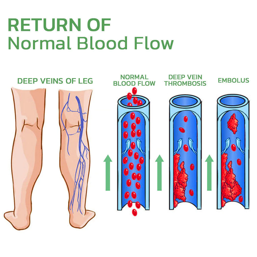 HealLegs™ Fat Burning Shaping & Varicose Veins Immediate Relief Burst Beads Patch - Image 2