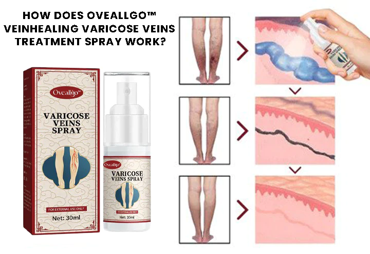Oveallgo™ VeinHealing Varicose Veins Treatment Spray - Image 2