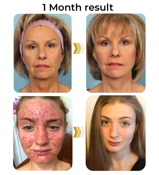 flysmus™ HERASKIN Australian Natural Pamper Cleansing Balm - Image 8