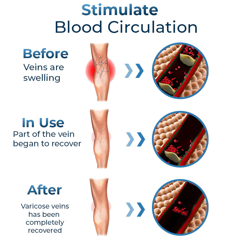 GFOUK™ Mucopolysaccharide Polysulfate Cream - Image 4