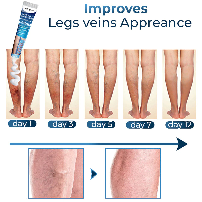 GFOUK™ Mucopolysaccharide Polysulfate Cream - Image 5