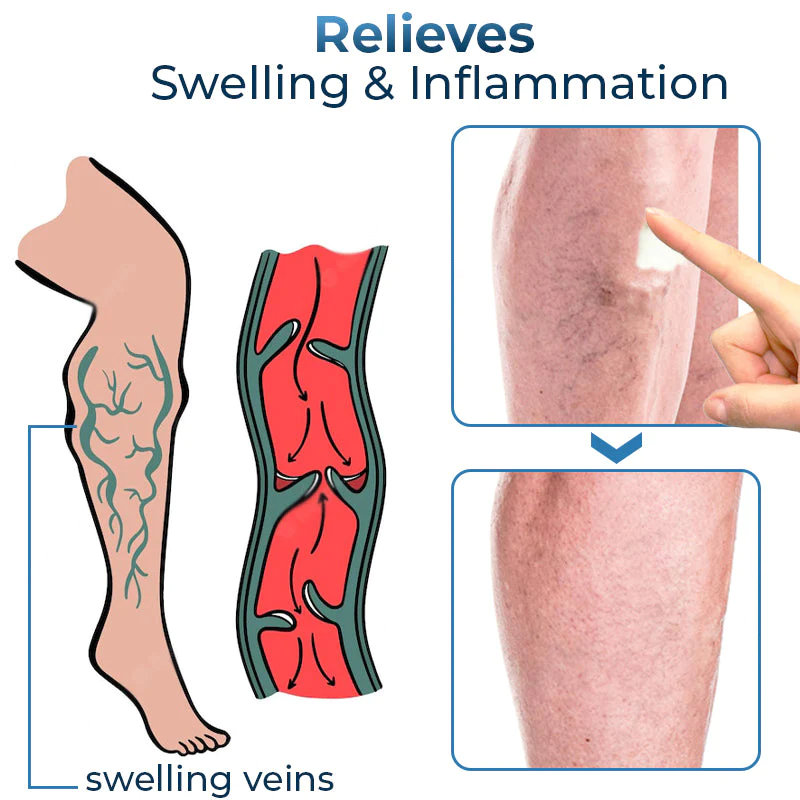 GFOUK™ Mucopolysaccharide Polysulfate Cream - Image 3