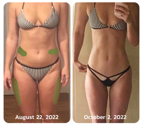 Oveallgo™ MugwortsLegs Cellulite Reduction Patches - Image 6