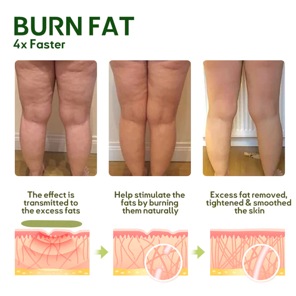 Oveallgo™ MugwortsLegs Cellulite Reduction Patches - Image 4