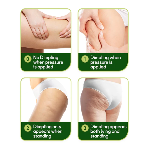 Oveallgo™ MugwortsLegs Cellulite Reduction Patches - Image 3