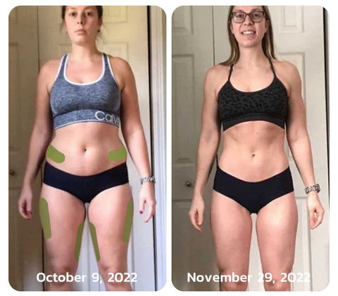 Oveallgo™ MugwortsLegs Cellulite Reduction Patches - Image 5