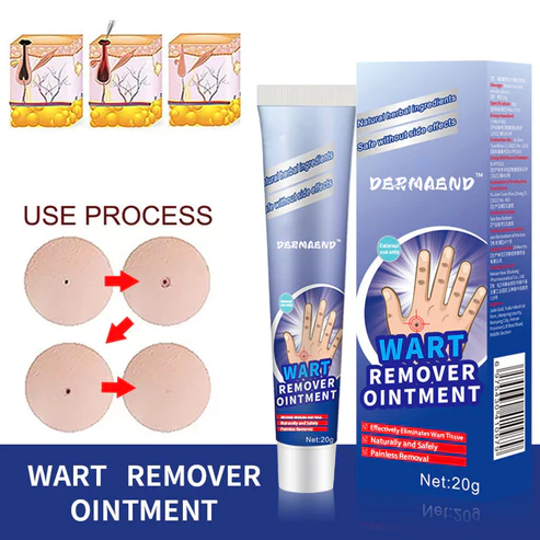 DermaEnd™ Wart Remover Herbal Ointment 100% Natural - Image 2