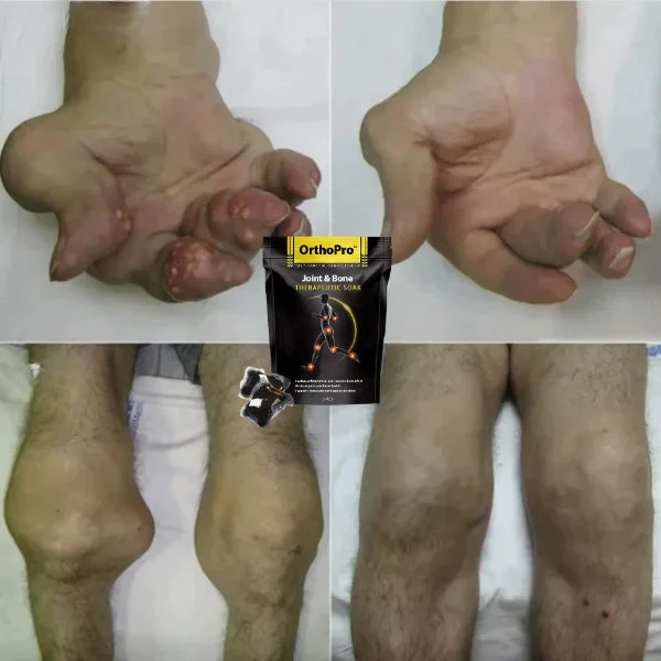 OrthoPro™ Joint & Bone Therapeutic Soak - Image 5