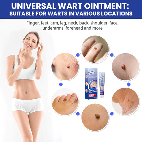 DermaEnd™ Wart Remover Herbal Ointment 100% Natural - Image 3