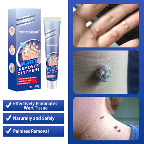 DermaEnd™ Wart Remover Herbal Ointment 100% Natural - Image 4