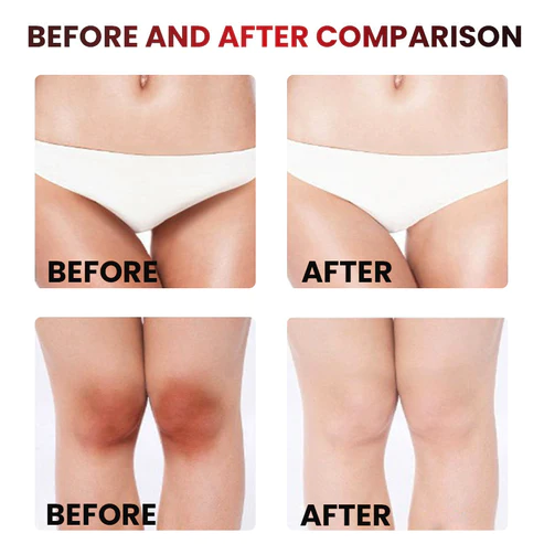 PinkVita™ Feminine Intimate Area Niacinamide Pinkish Whitening Essence - Image 6