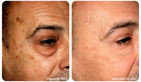 LOVILDS™ Tea Tree Hexapeptide Firming Eye Cream - Image 2