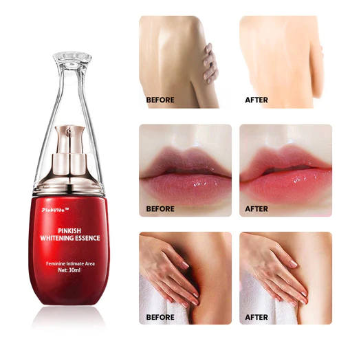 PinkVita™ Feminine Intimate Area Niacinamide Pinkish Whitening Essence - Image 2