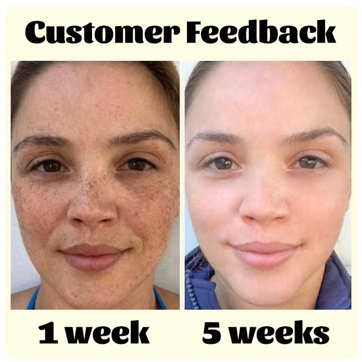 Ceoerty™ RadiantTouch Dark Spot Corrector Serum - Image 8