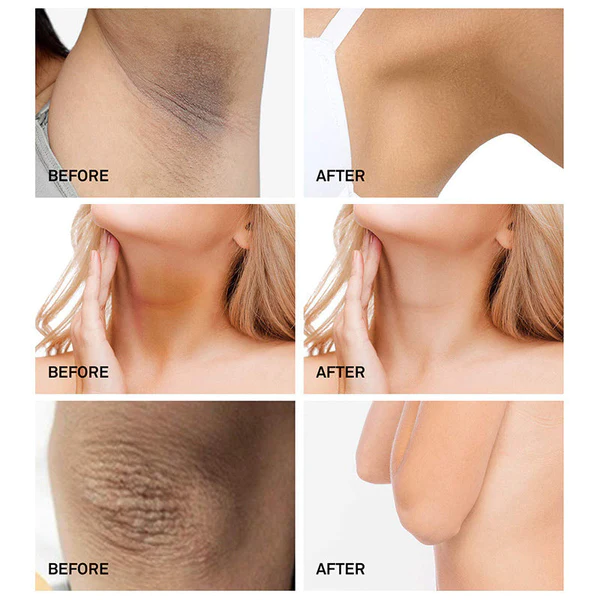 SilvaGlow™ Niacinamide Intimate Areas Whitening Cream - Image 4