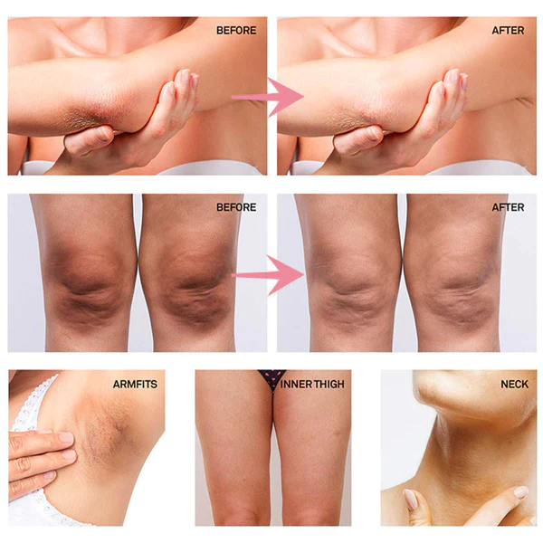 SilvaGlow™ Niacinamide Intimate Areas Whitening Cream - Image 7