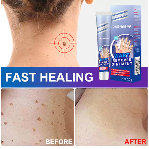 DermaEnd™ Wart Remover Herbal Ointment 100% Natural - Image 9