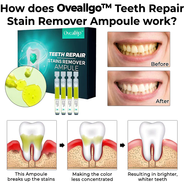 Oveallgo™ Teeth Repair Stain Remover Ampoule - Image 2