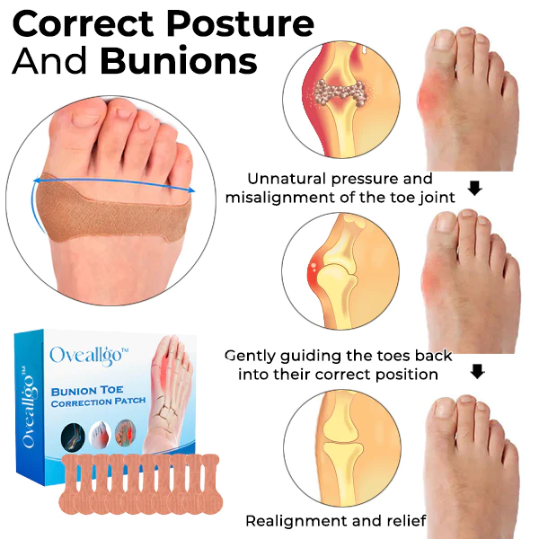 Oveallgo™ Bunion Toe Correction Patch - Image 3