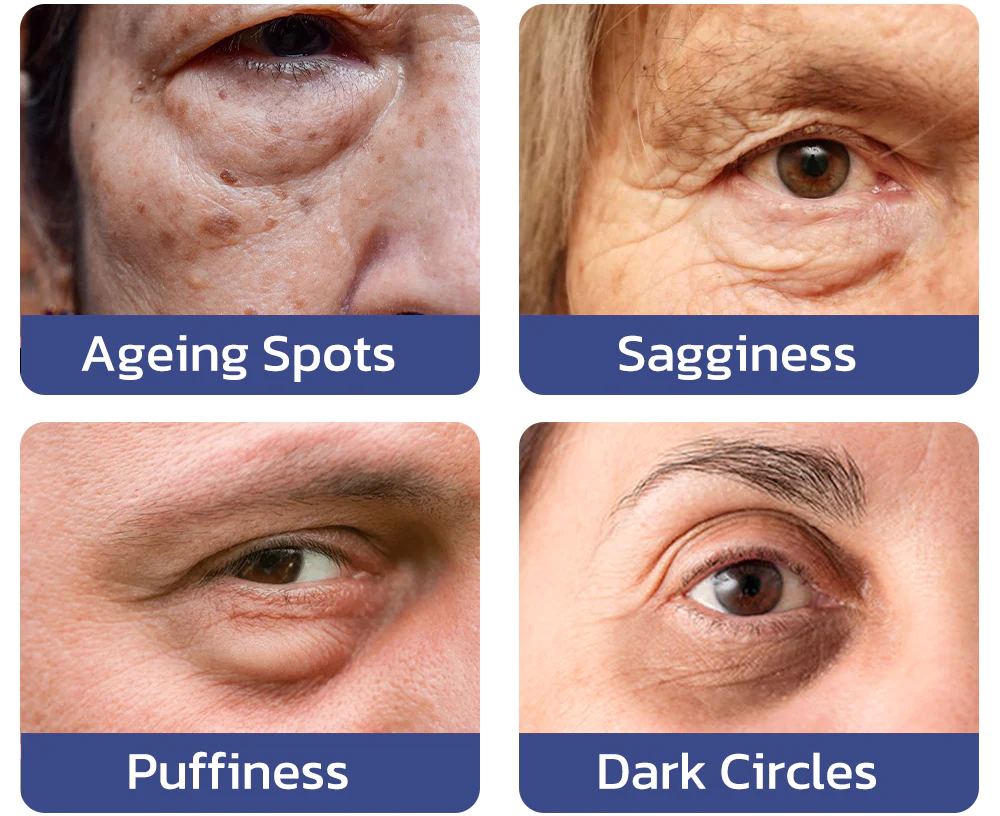 LOVILDS™ Tea Tree Hexapeptide Firming Eye Cream - Image 8