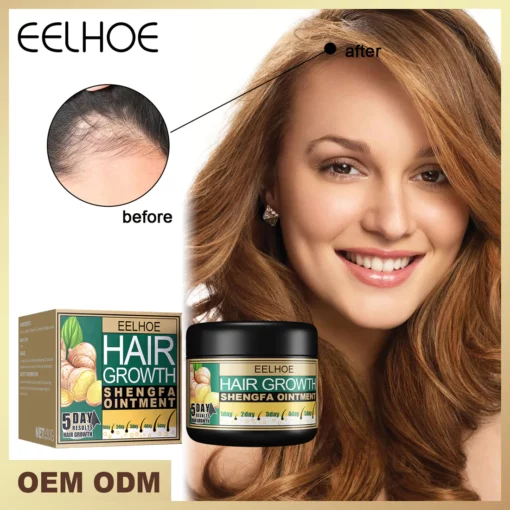 I-EELHOE™ Hair Boost Ginger Cream