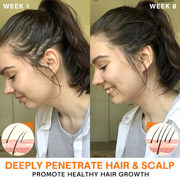 Oveallgo™ FINAS Prestige Hair-Regrowth Ampoules - Image 5