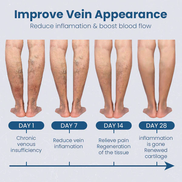 Ceoerty™ Vein Defense MPS Cream - Image 4