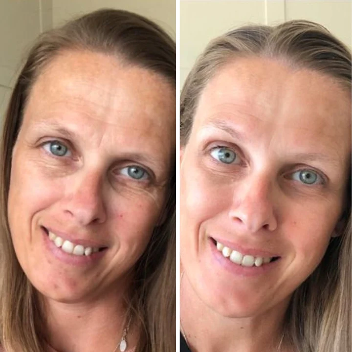 Oveallgo™ Youth Magic Essence Mist - Image 2