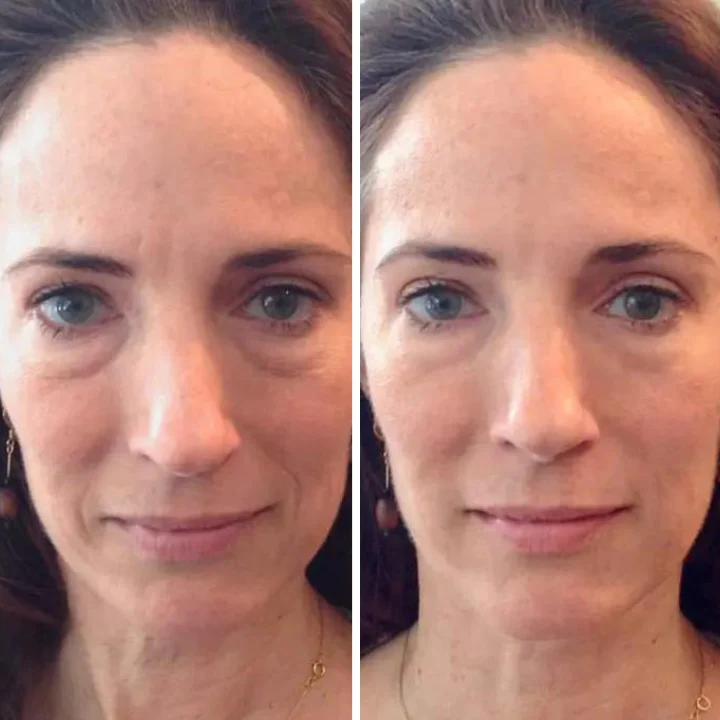 Oveallgo™ Youth Magic Essence Mist - Image 3