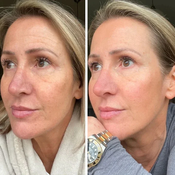 Oveallgo™ Youth Magic Essence Mist - Image 4