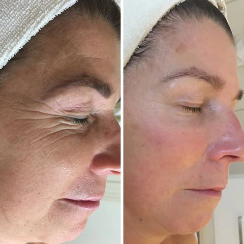 Peeluxe™ Yeast Egg Shell Mask Cream - Image 6