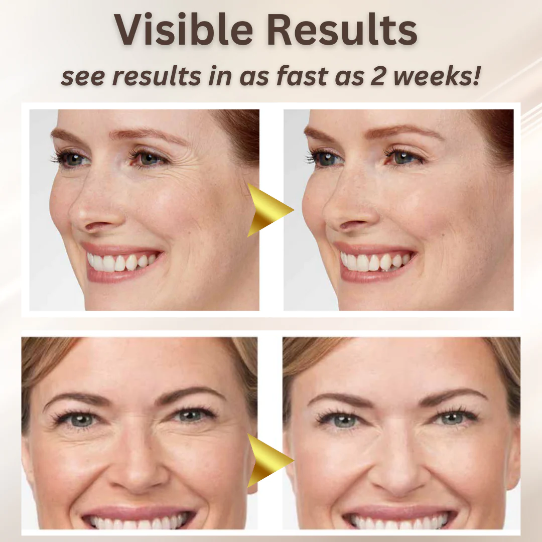 ESSENTIALLÉ™ Instant Skin Lift Thread Set - Image 3