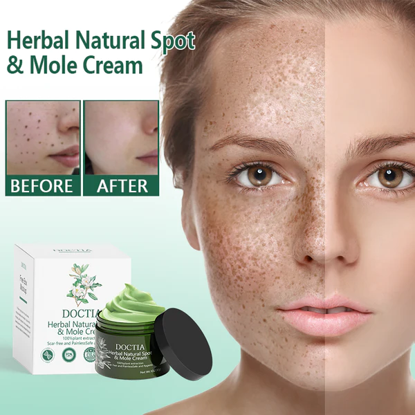 DOCTIA™Herbal Natural Spot & Mole Cream - Image 4