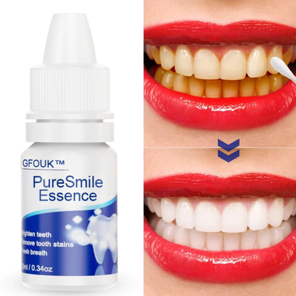 GFOUK™️ PureSmile Essence - Image 2