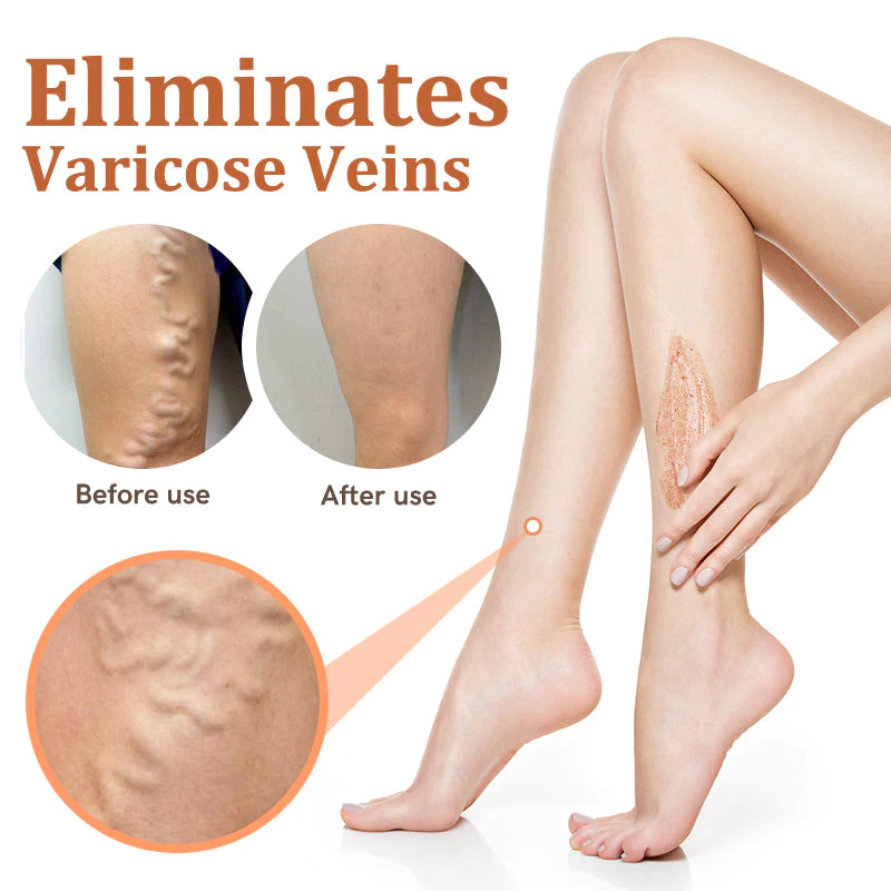 flysmus™ Vein Soothing Scrub - Image 2